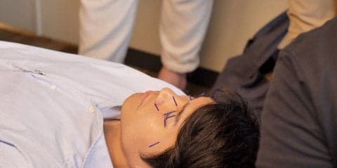 日本eスポーツトレーナー協会（JeSTA）が実技講習会を開催 指圧とハリによるデモンストレーションを実施（後編）